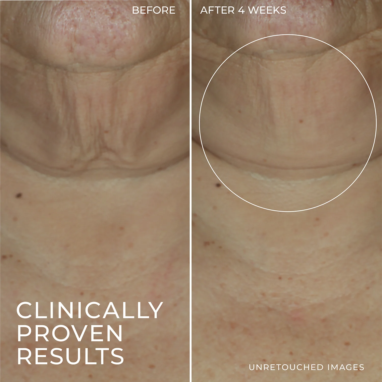 DERM CORREXION® Firming Serum Stick 5 DERM CORREXION® Firming Serum Stick