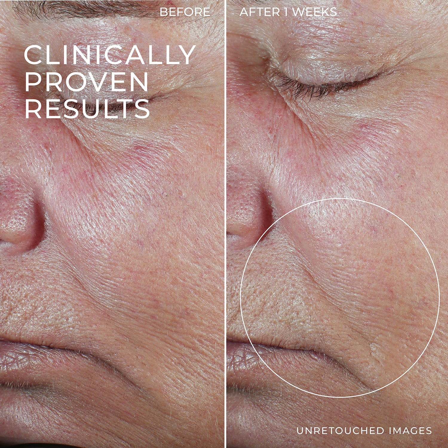 DERM CORREXION® Firming Serum Stick 7 DERM CORREXION® Firming Serum Stick