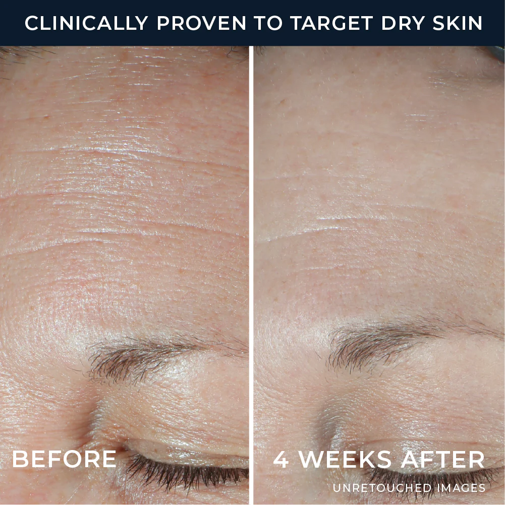 Hydration+ Moisturizer 4 Hydration+ Moisturizer