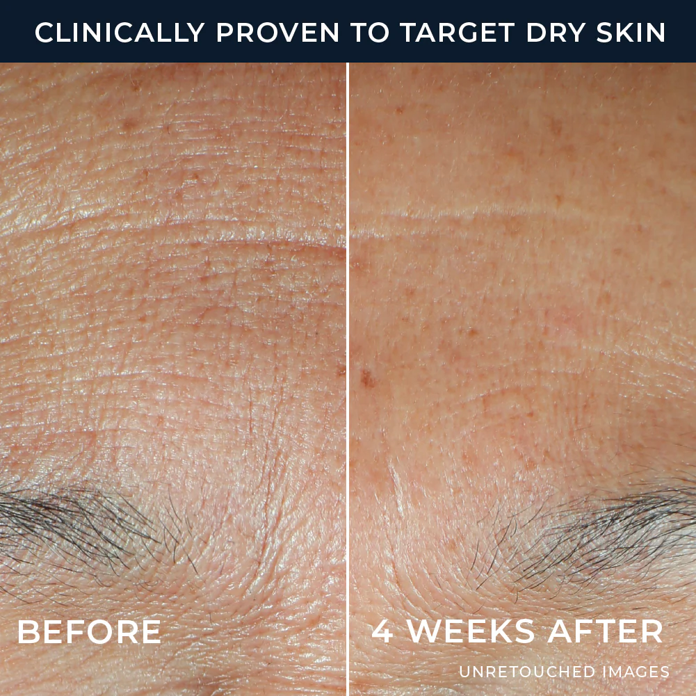 Hydration+ Serum 4 Hydration+ Serum