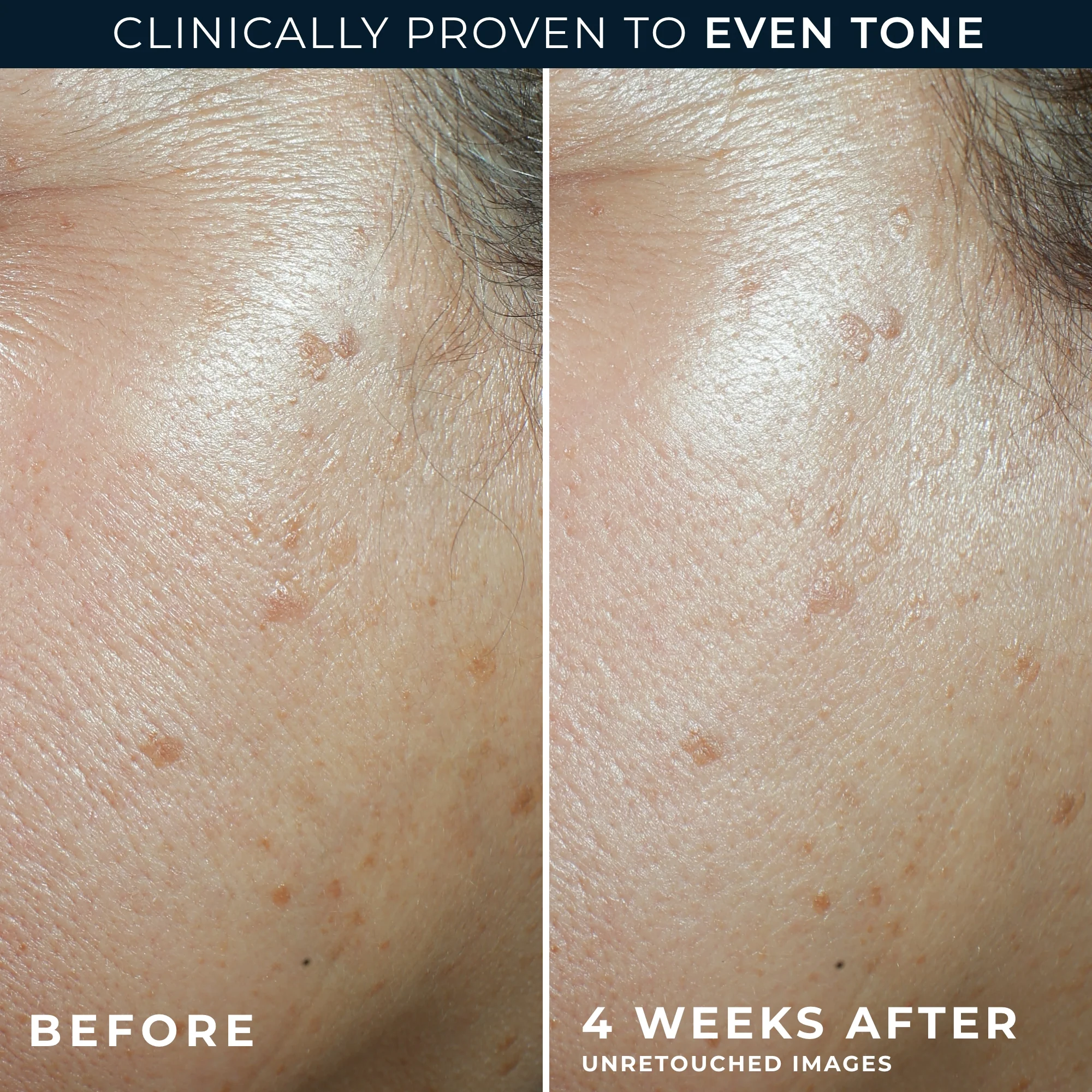 MULTI CORREXION® Even Tone + Lift Daily Moisturizer SPF 30 5 MULTI CORREXION® Even Tone + Lift Daily Moisturizer SPF 30