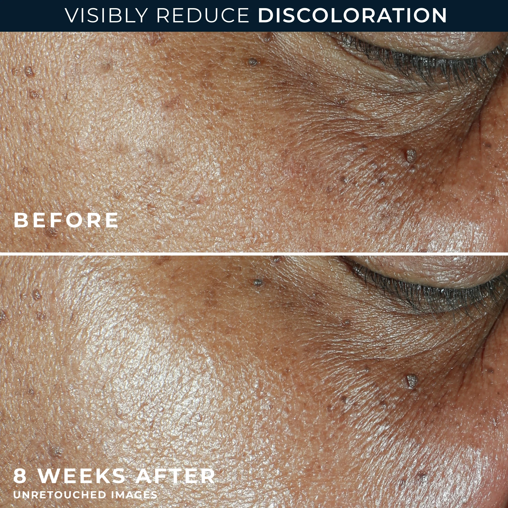 MULTI CORREXION® Even Tone + Lift Daily Moisturizer SPF 30 6 MULTI CORREXION® Even Tone + Lift Daily Moisturizer SPF 30