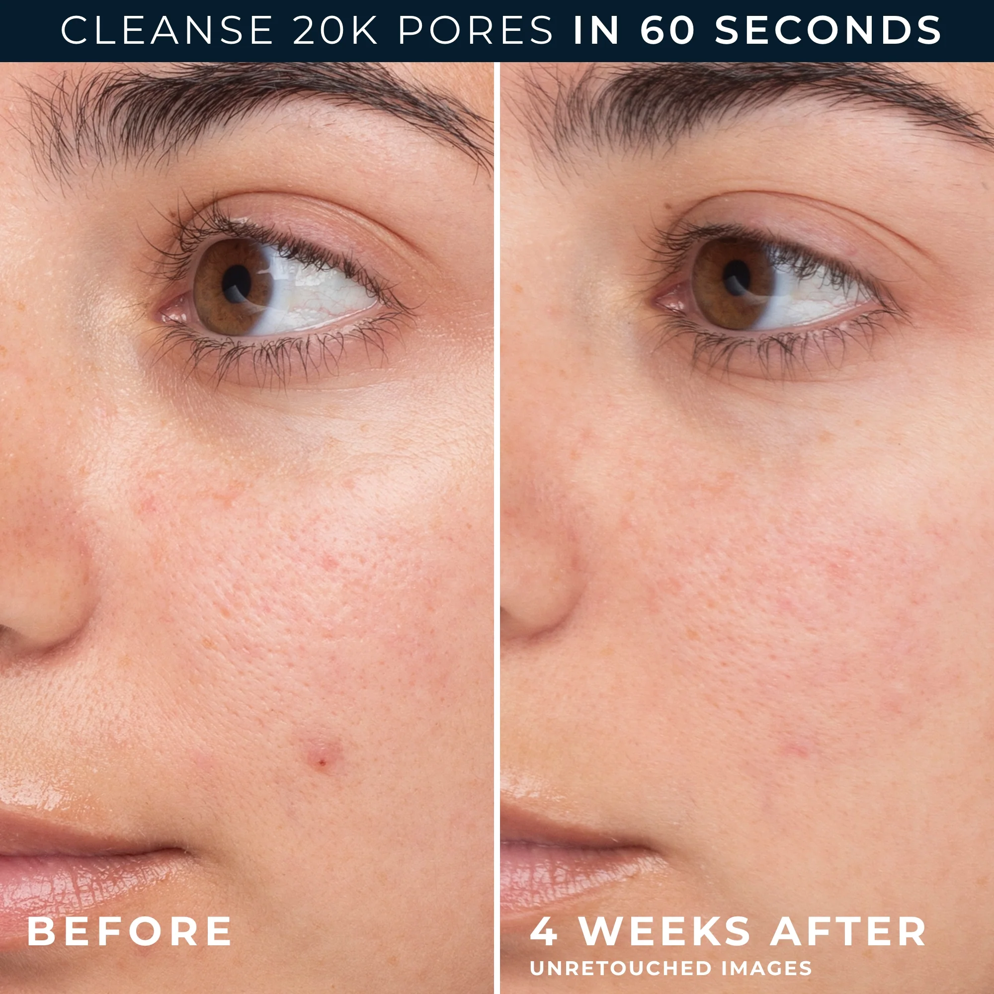 Barrier Renew® Gel-To-Foam Cleanser 5 Barrier Renew® Gel-To-Foam Cleanser