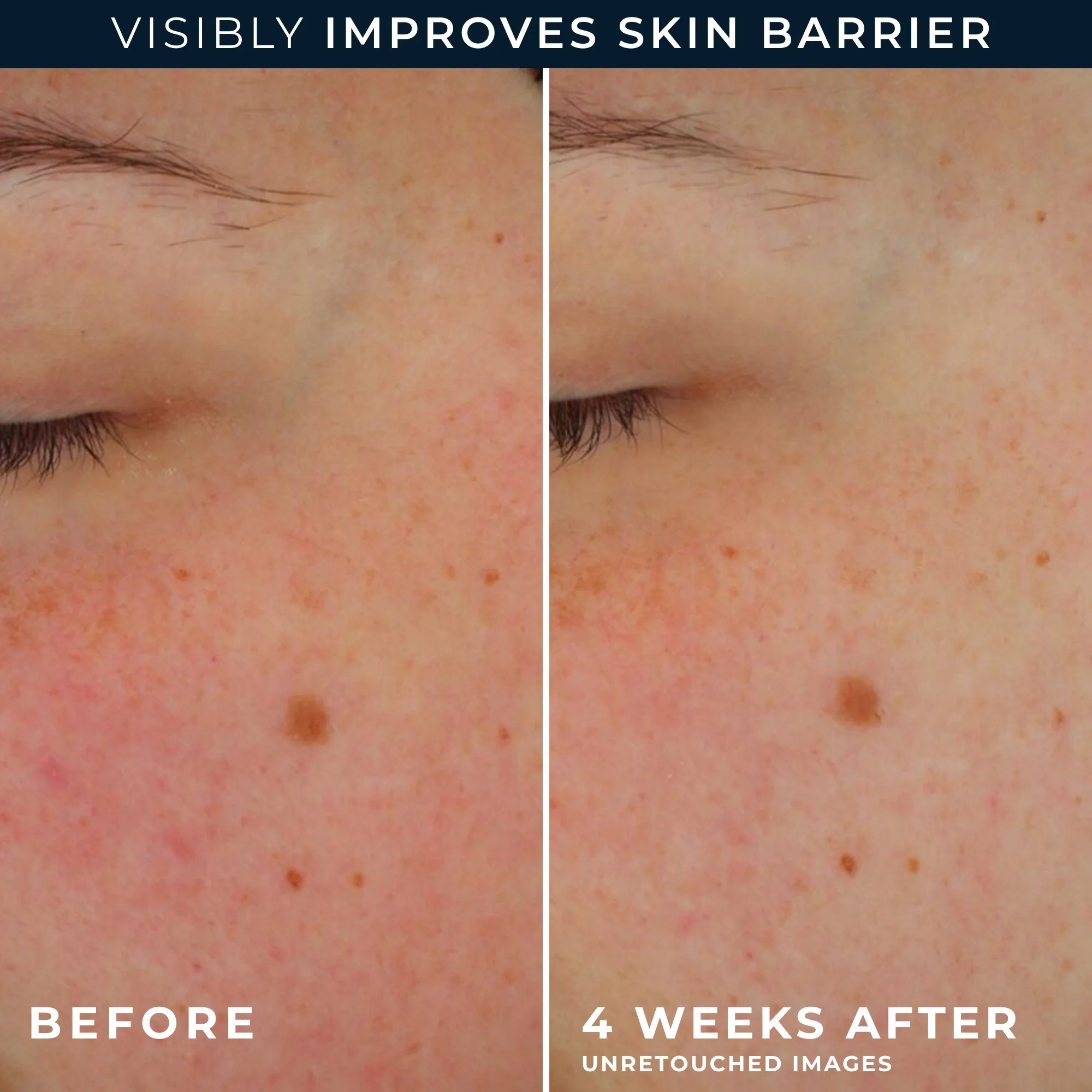 Barrier Renew® AM Moisturizer SPF 30 5 Barrier Renew® AM Moisturizer SPF 30