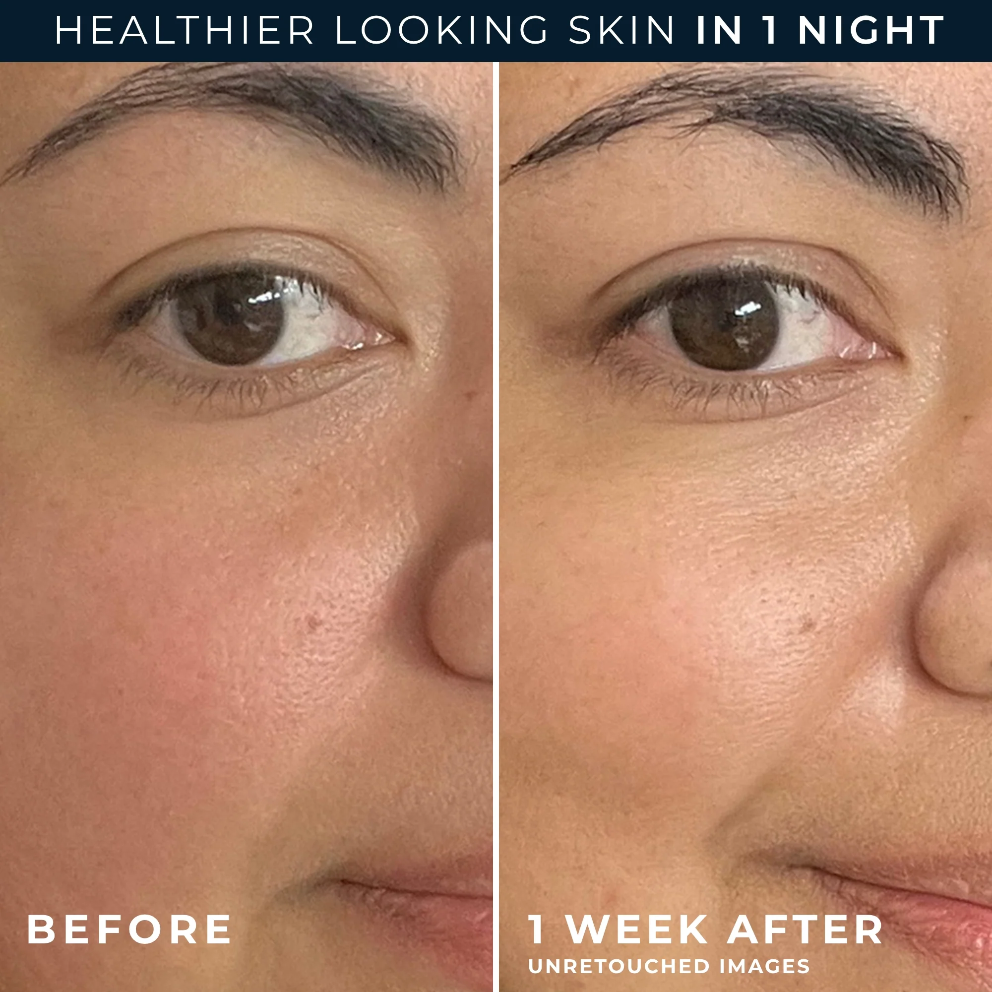 Barrier Renew® PM Moisturizer 5 Barrier Renew® PM Moisturizer