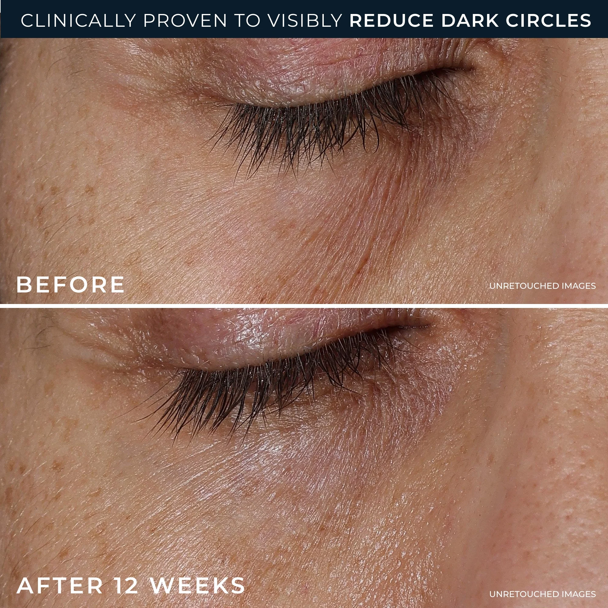 DERM CORREXION® Eye Repair Dark Circle Cream 4 DERM CORREXION® Eye Repair Dark Circle Cream