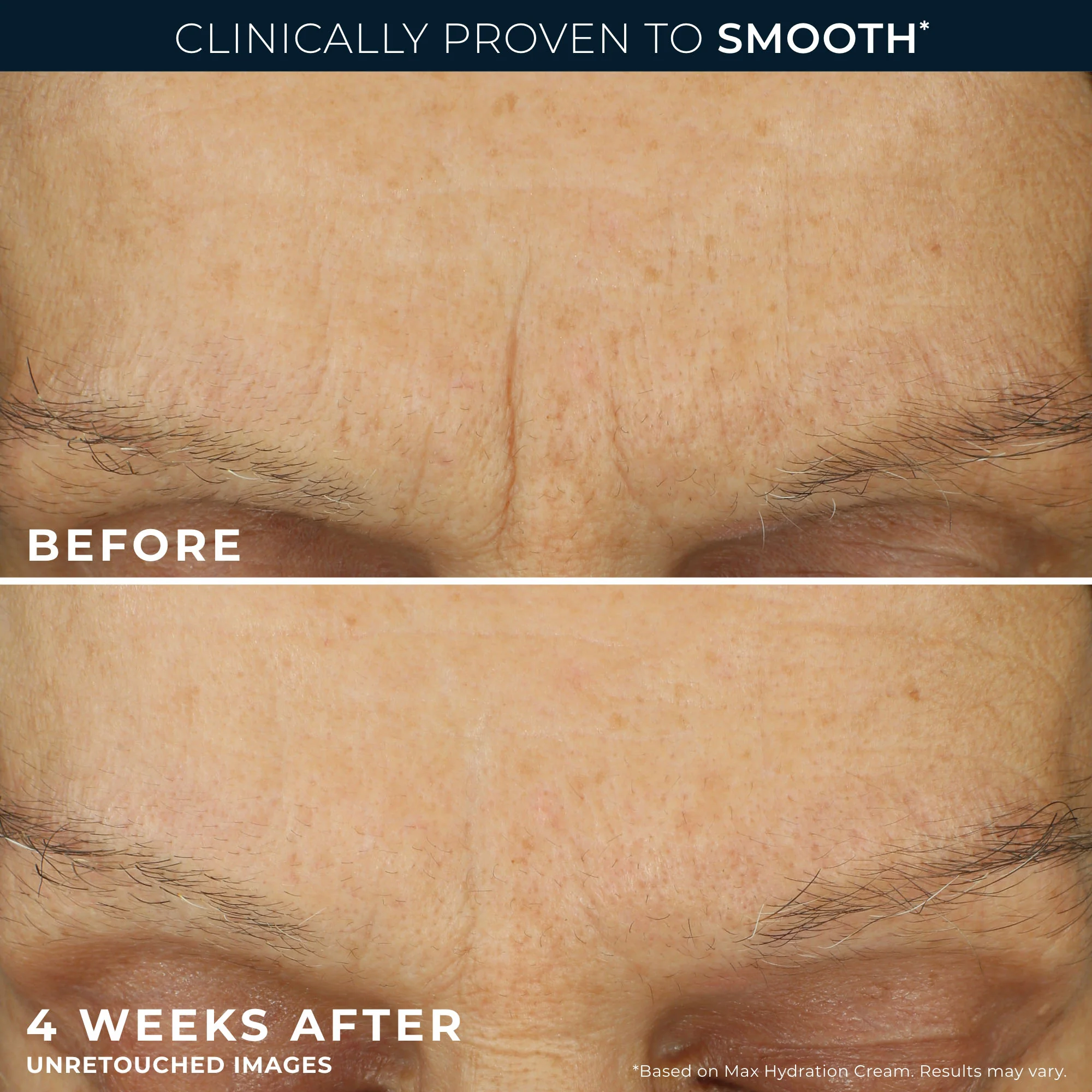 Pure RoC® Retinol Starter Set 4 Pure RoC® Retinol Starter Set