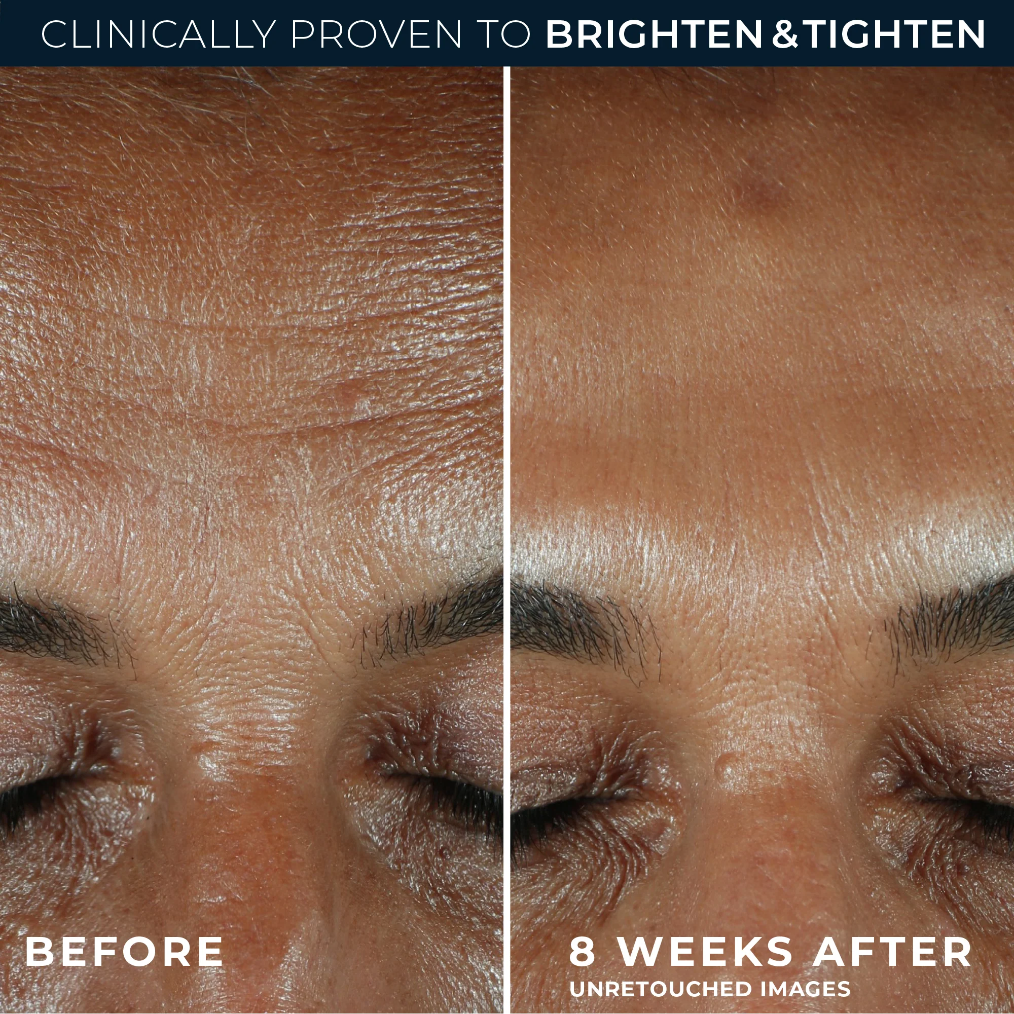 MULTI CORREXION® Revive + Glow Daily Serum 4 MULTI CORREXION® Revive + Glow Daily Serum