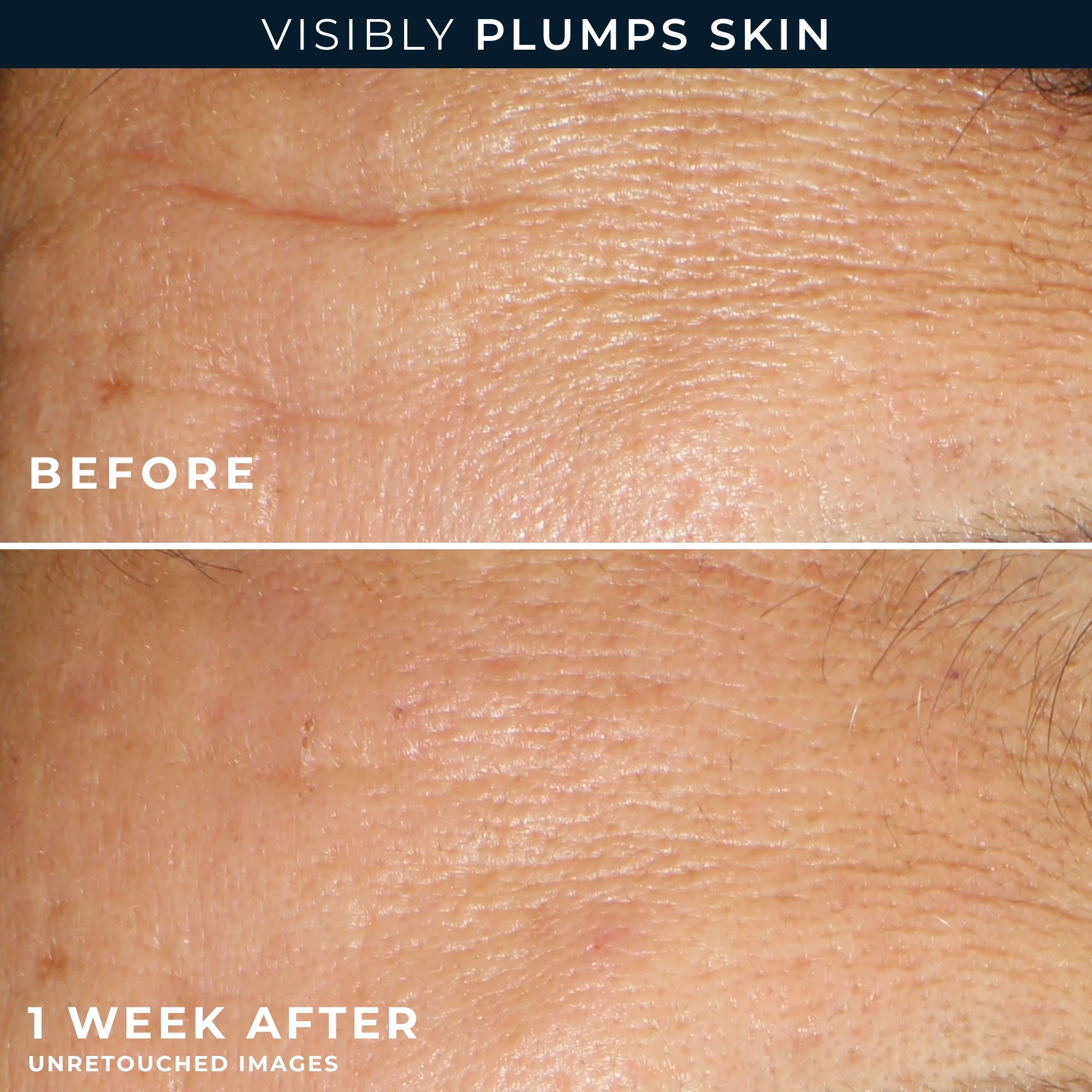 Hydration+ Serum Capsules 4 Hydration+ Serum Capsules