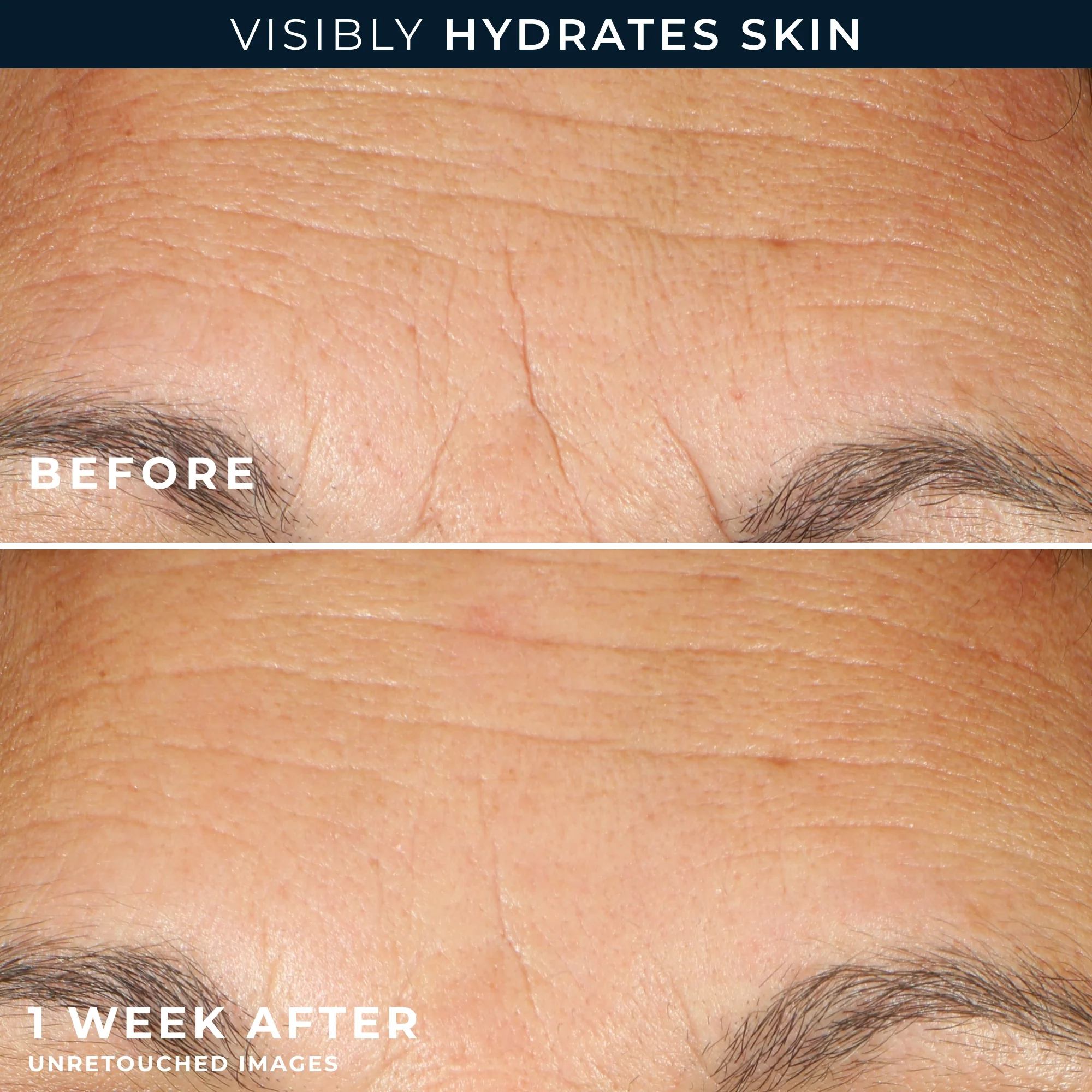 Hydration+ Serum Capsules 5 Hydration+ Serum Capsules