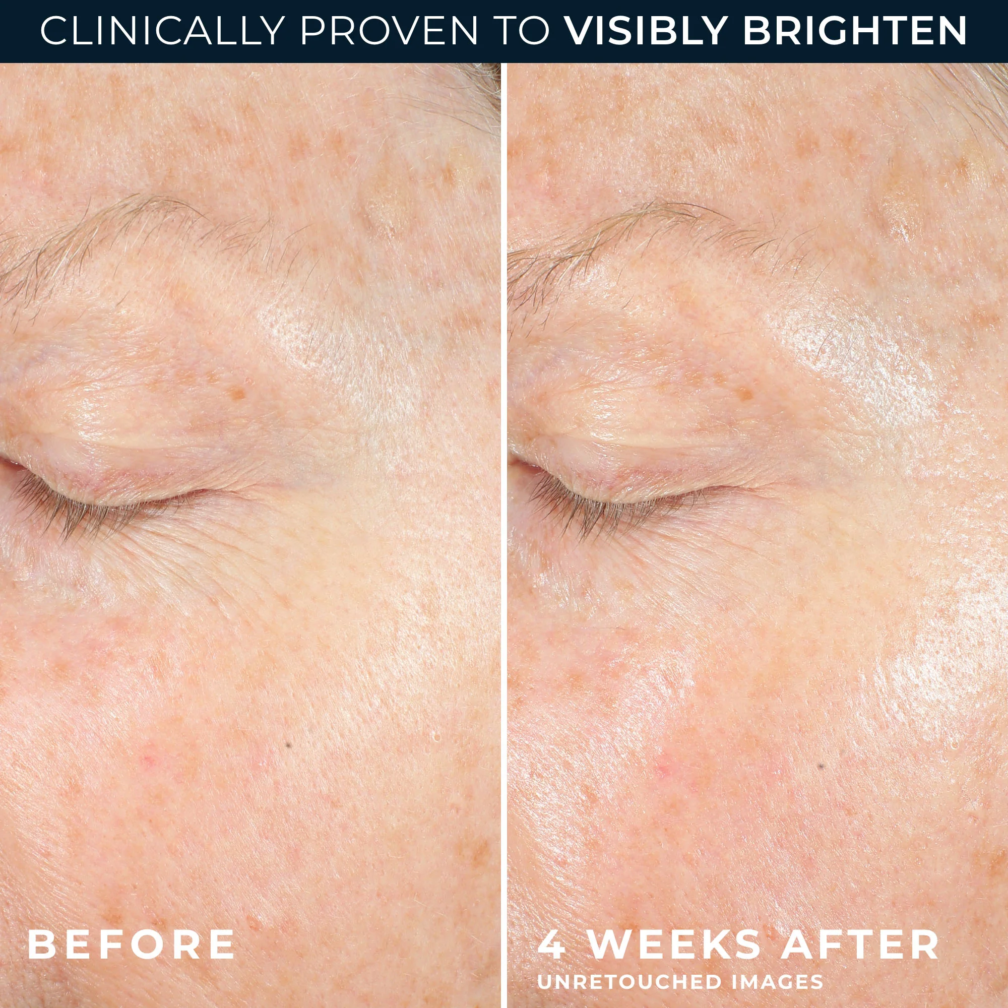 MULTI CORREXION® Revive + Glow Moisturizer 5 MULTI CORREXION® Revive + Glow Moisturizer