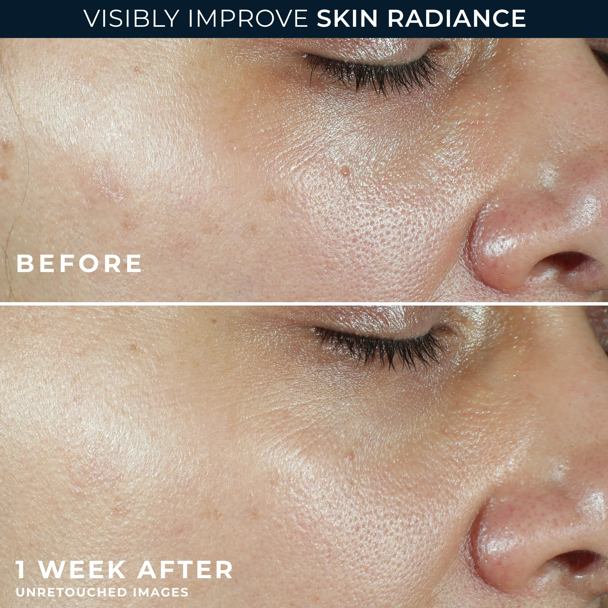 MULTI CORREXION® Revive + Glow Moisturizer SPF 30 5 MULTI CORREXION® Revive + Glow Moisturizer SPF 30