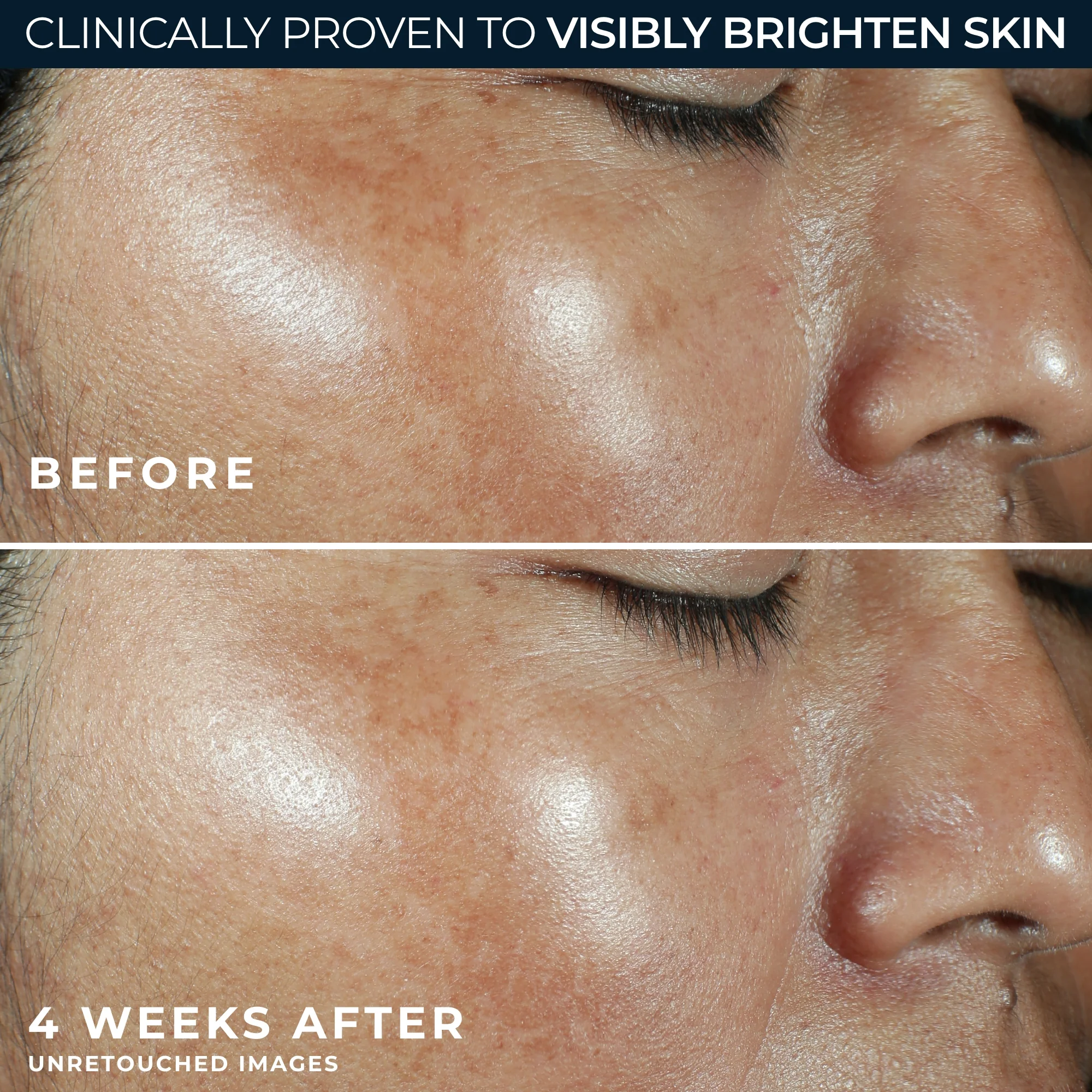 MULTI CORREXION® Revive + Glow Moisturizer SPF 30 6 MULTI CORREXION® Revive + Glow Moisturizer SPF 30