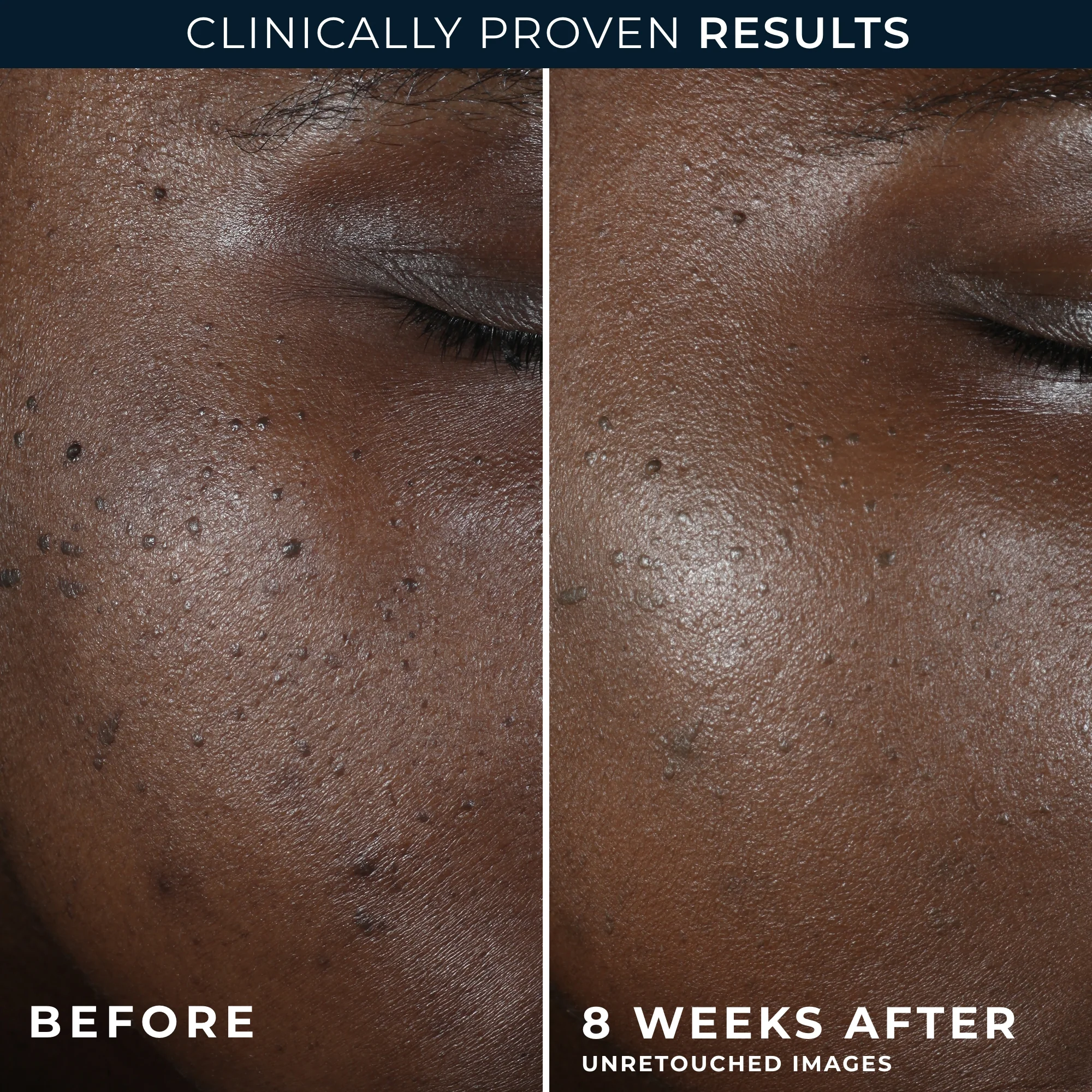 MULTI CORREXION® Even Tone + Lift Night Cream 5 MULTI CORREXION® Even Tone + Lift Night Cream