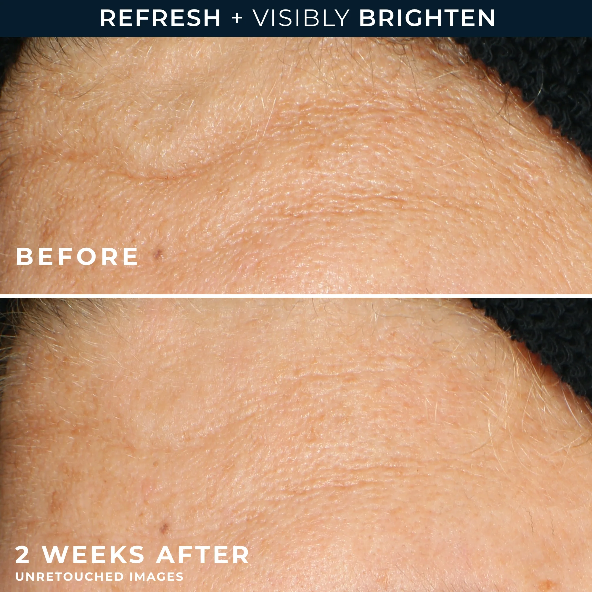 MULTI CORREXION® Revive + Glow Gel Cleanser 5 MULTI CORREXION® Revive + Glow Gel Cleanser