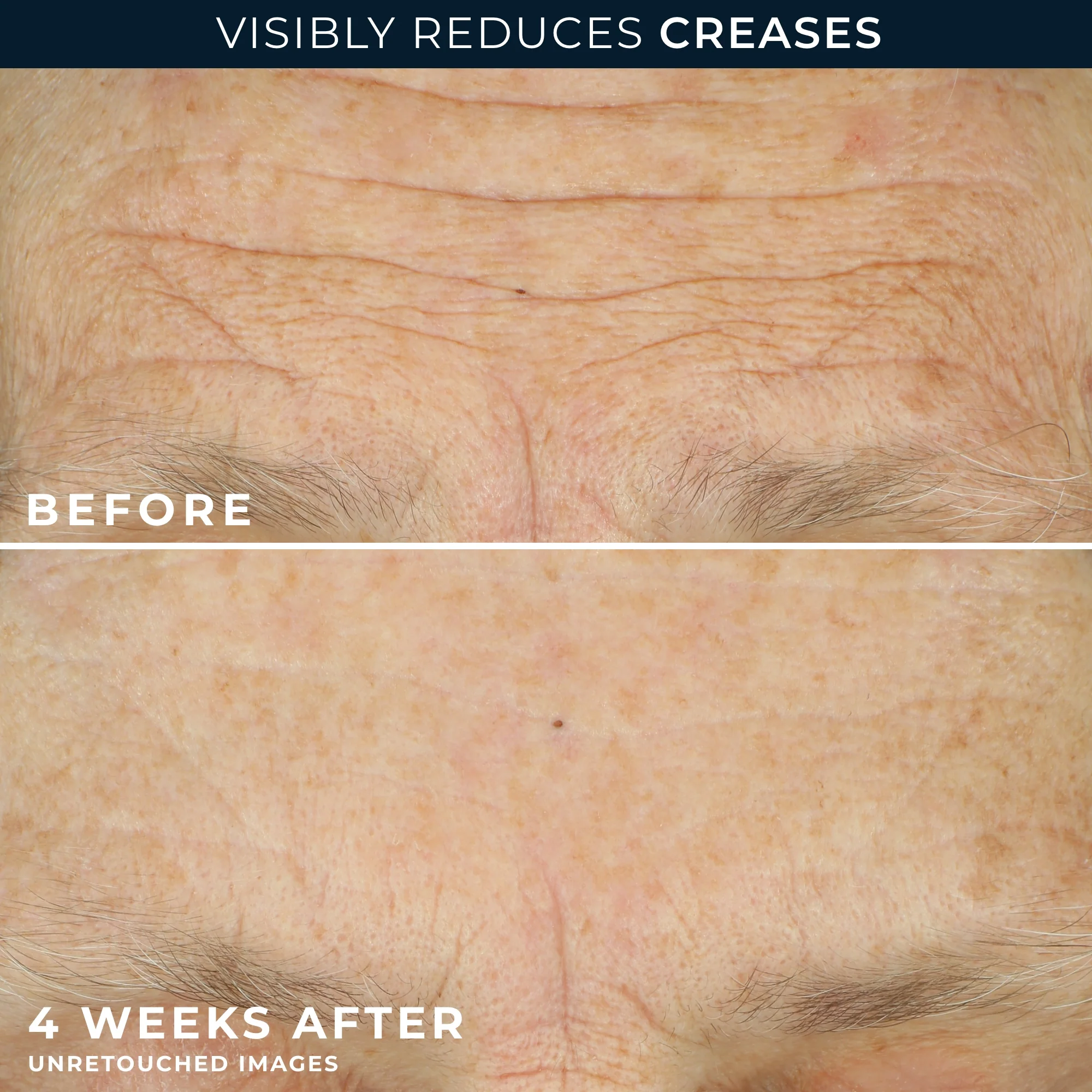 MULTI CORREXION® Crépe Repair Face & Neck Cream 5 MULTI CORREXION® Crépe Repair Face & Neck Cream