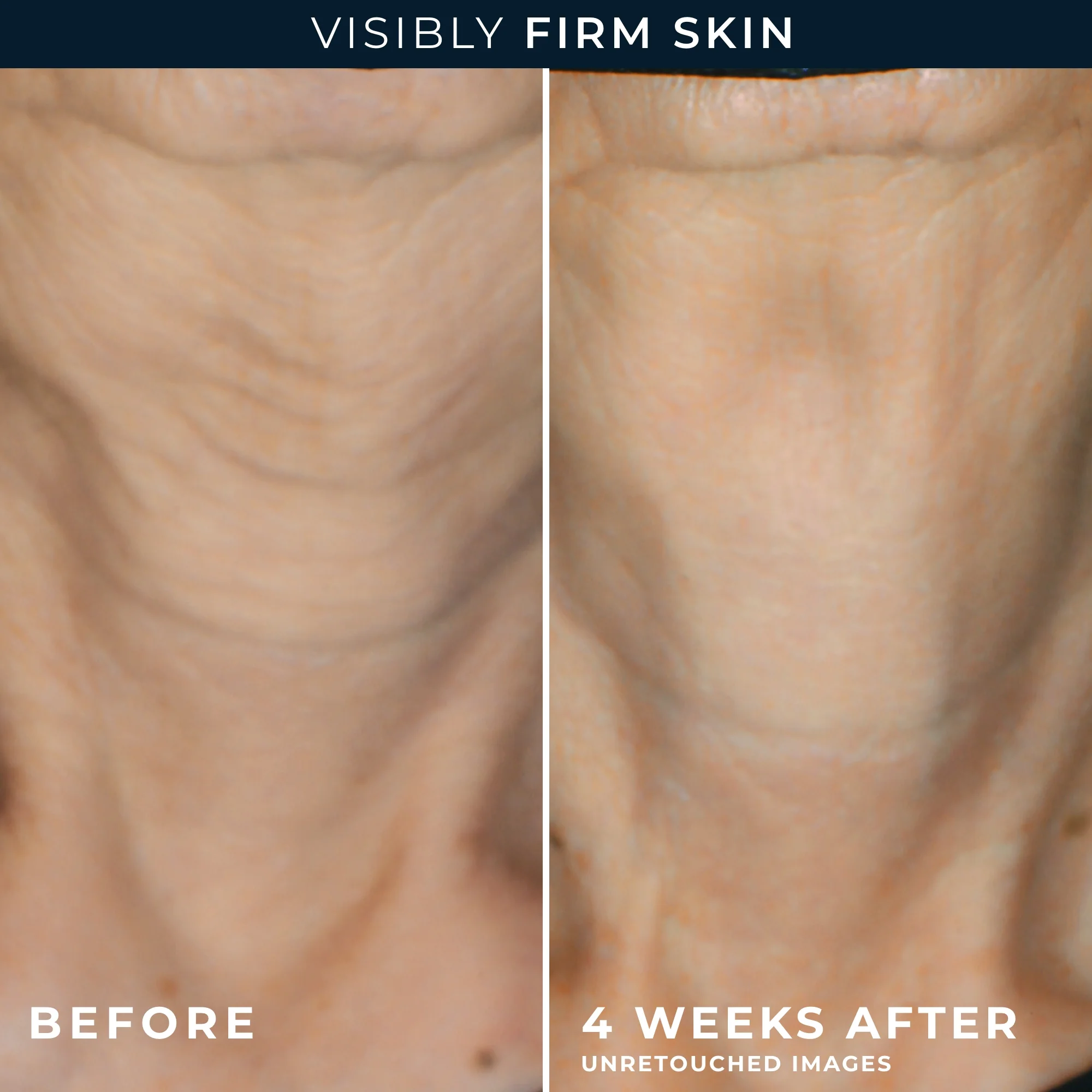 MULTI CORREXION® Crépe Repair Face & Neck Cream 6 MULTI CORREXION® Crépe Repair Face & Neck Cream