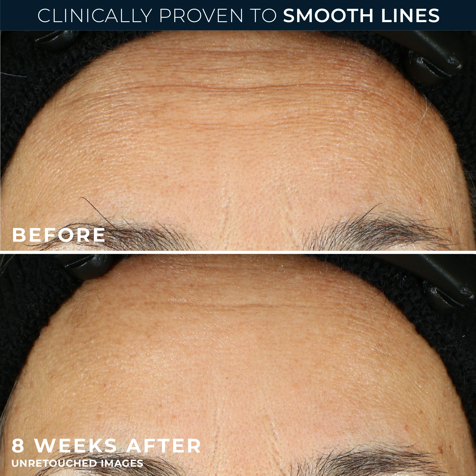 RETINOL CORREXION® Line Smoothing Night Serum Capsules Mini 4 RETINOL CORREXION® Line Smoothing Night Serum Capsules Mini